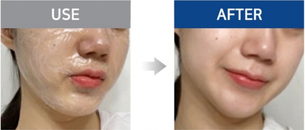 review mặt nạ nâng cơ soqu miracle-s lifting up face mask